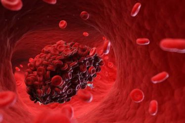 268611 blood clots 50.jpg