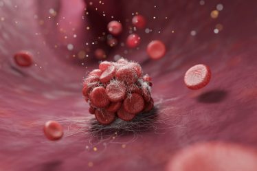 blood clot scaled.jpg
