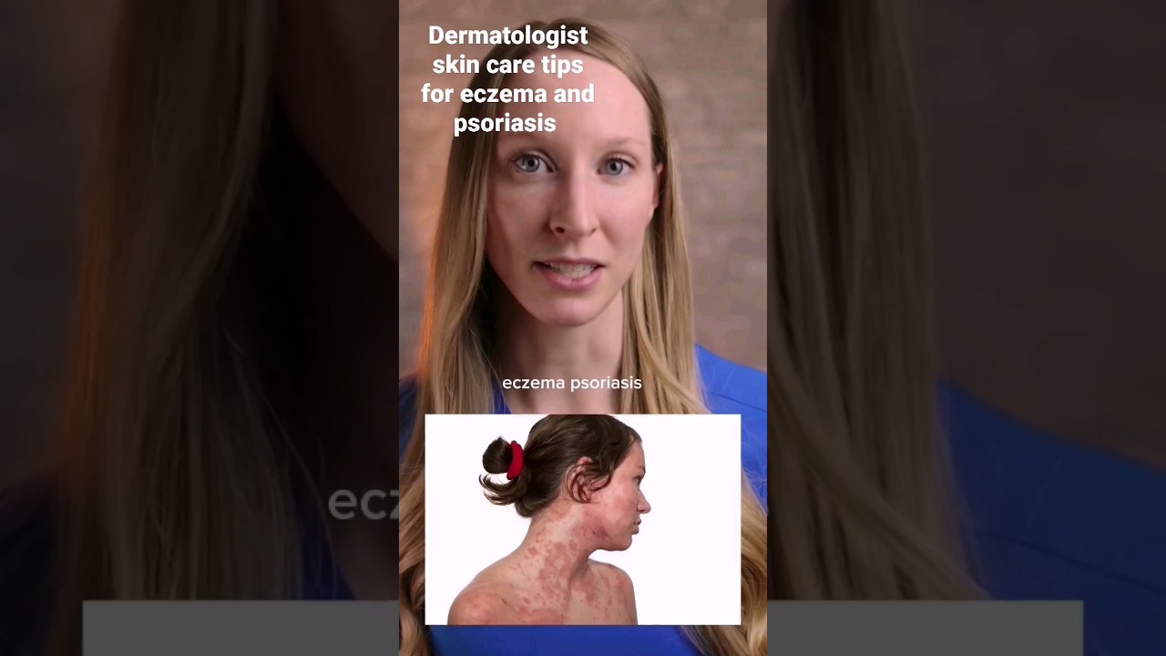 1741598536 maxresdefault.jpg