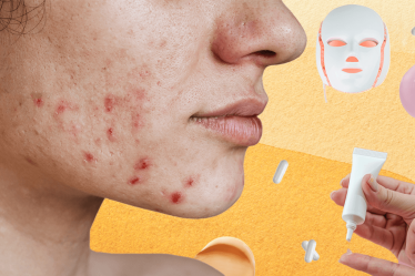 acne meta.png